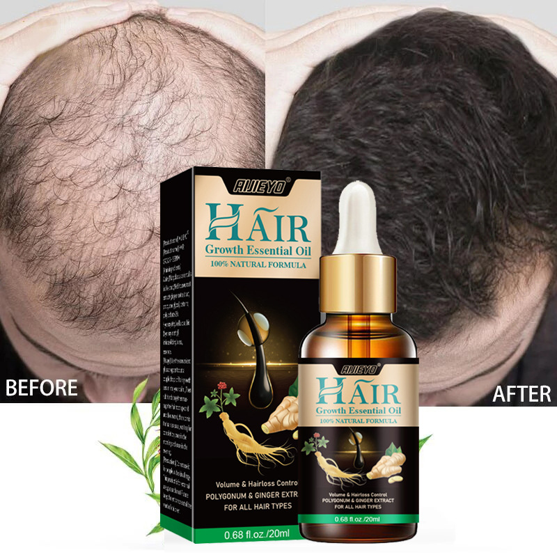 Epidermal Growth Factor - 2023 بيوتين زيت نمو الشعر السريع