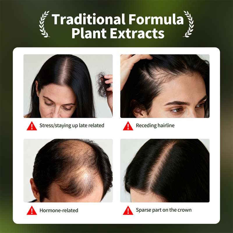 مجموعة نمو الشعر الطبيعي صابون - مراجعة Epidermal Growth Factor وسعره