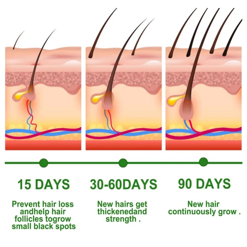 مصل نمو الشعر مجموعة العناية ب - مراجعة Epidermal Growth Factor وسعره