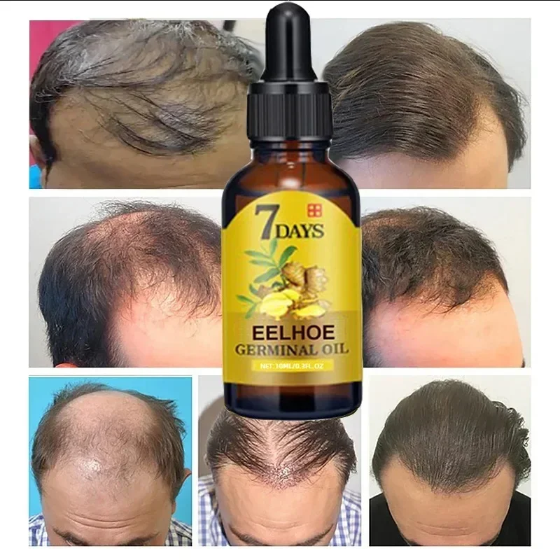 زيت نمو الشعر السريع لمدة 7 أي - مراجعة Epidermal Growth Factor وسعره