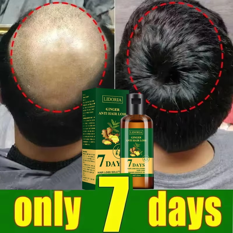 سيروم نمو الشعر، كبسولات أساسي - مراجعة Epidermal Growth Factor وسعره