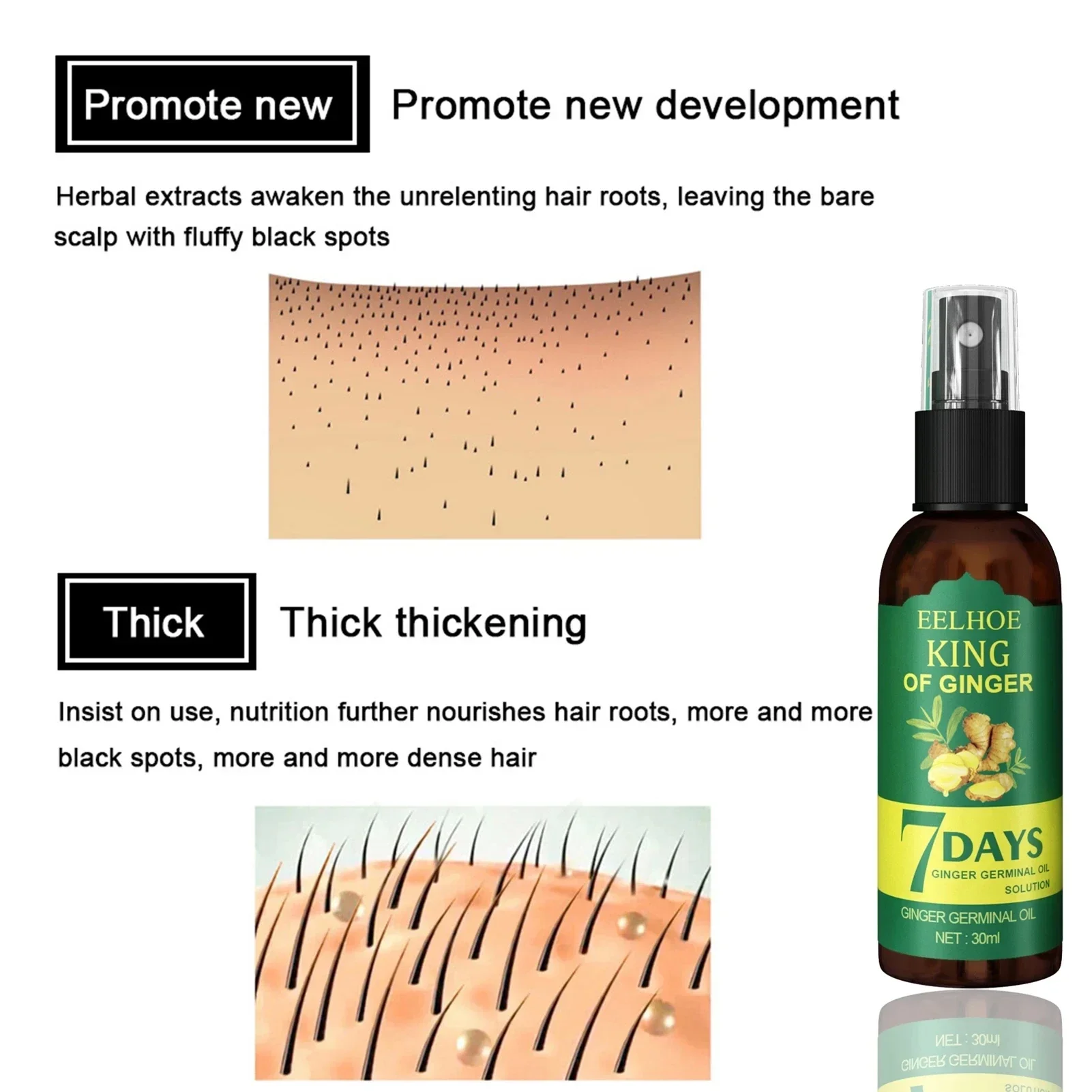 بشاخ لنمو شعر الزنجبيل للرجال  - مراجعة Epidermal Growth Factor وسعره